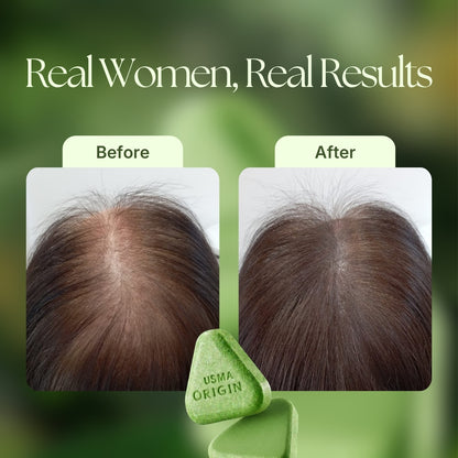 USMA ORIGIN™ - Shampoo Bar