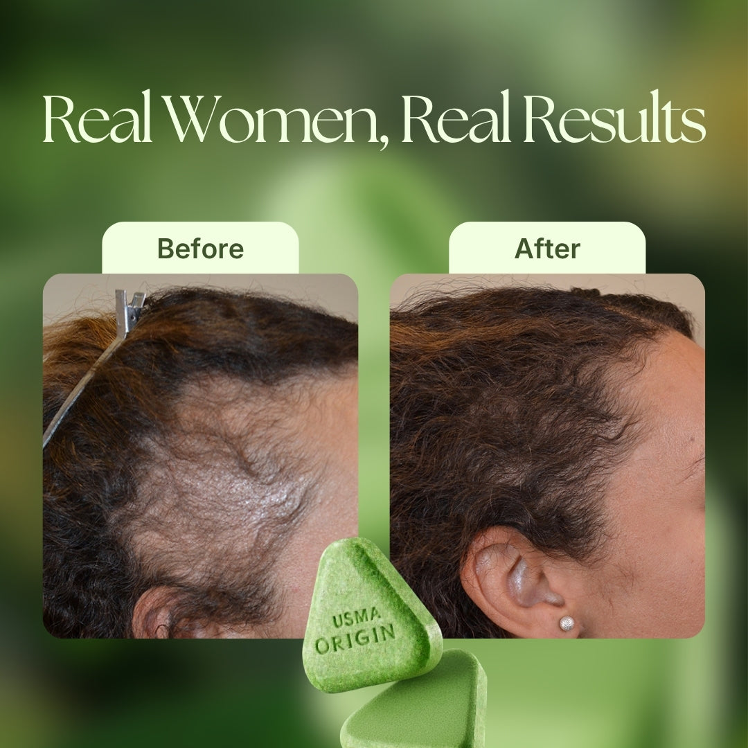 USMA ORIGIN™ - Shampoo Bar