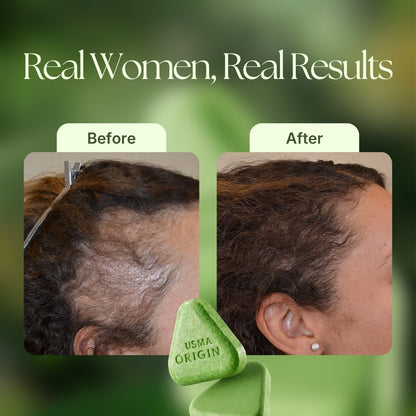 USMA ORIGIN™ - Shampoo Bar